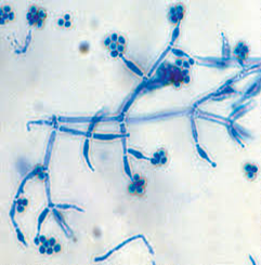 image 6 - Fungos do gênero Trichoderma ssp.: Eficiência e sustentabilidade.